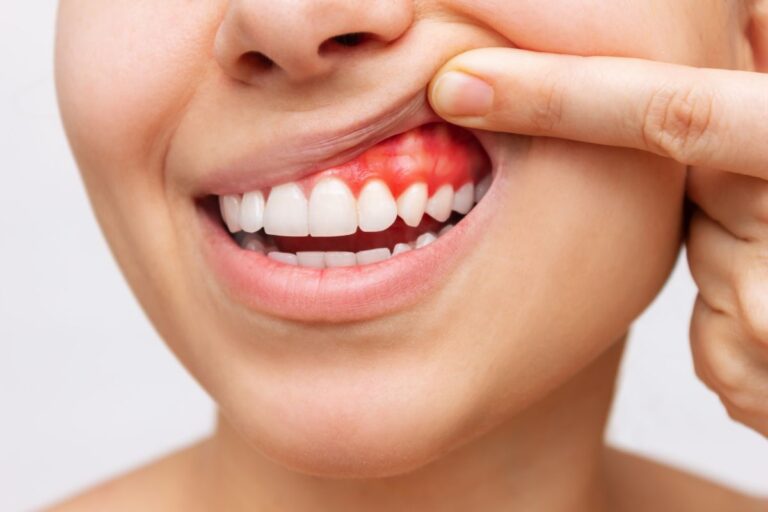 Budowa zęba, czyli jak zbudowany jest ząb?